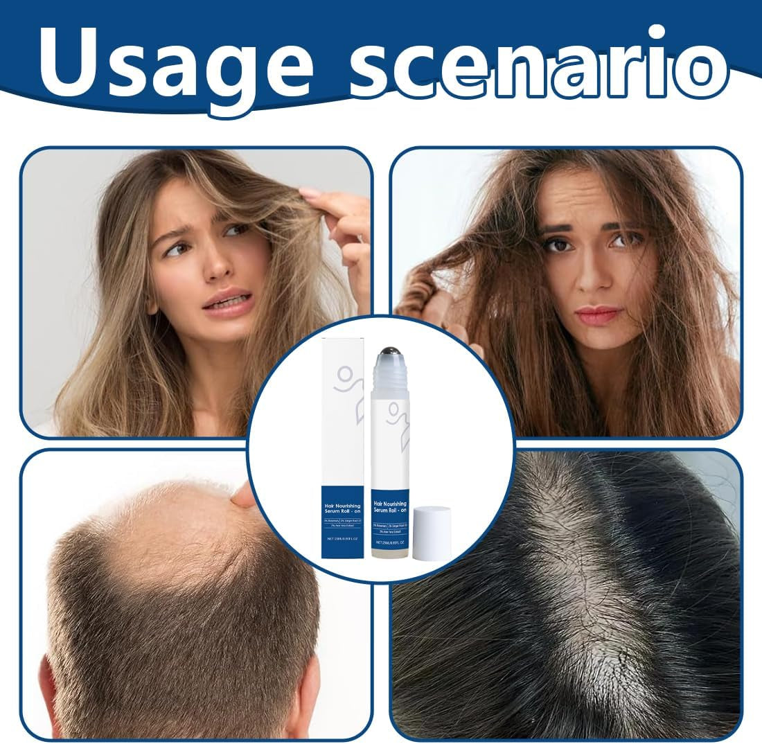 1 Piezas Rosemary - Suero Para El Crecimiento Del Cabello Roll-On, Suero De Control De Caída Del Cabello Del Cuero Cabelludo Aumenta El Flujo De Oxígeno, Reduce La Caída