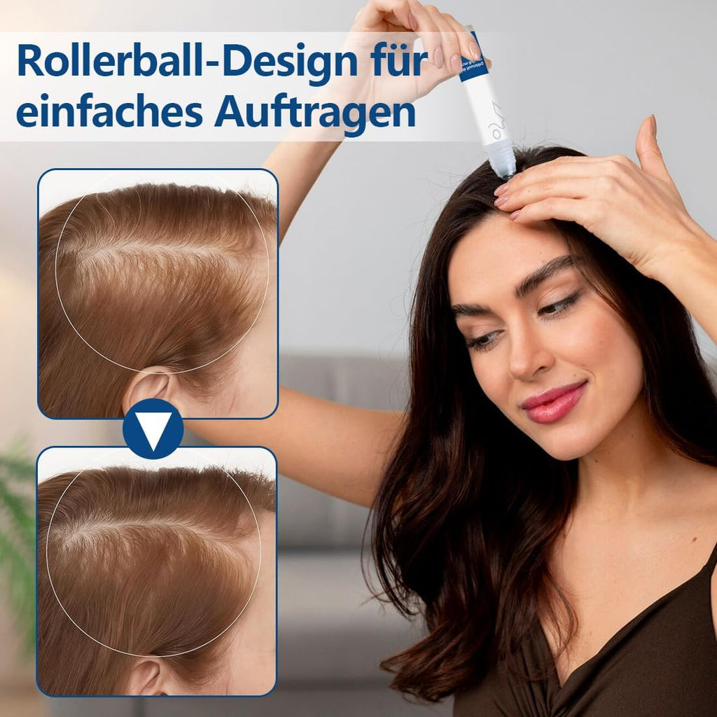 1 Piezas Rosemary - Suero Para El Crecimiento Del Cabello Roll-On, Suero De Control De Caída Del Cabello Del Cuero Cabelludo Aumenta El Flujo De Oxígeno, Reduce La Caída